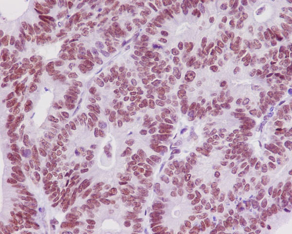 Rabbit Monoclonal to TRAF6