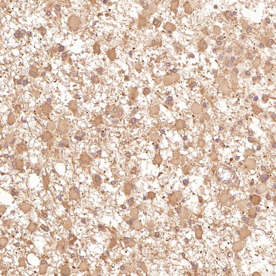 Rabbit Monoclonal to TRAF6