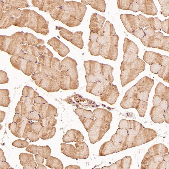Rabbit Monoclonal to TRAF6