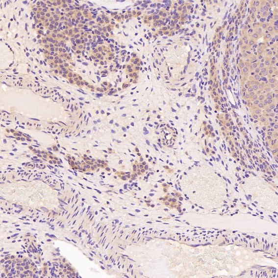 Rabbit Monoclonal to TRAF6