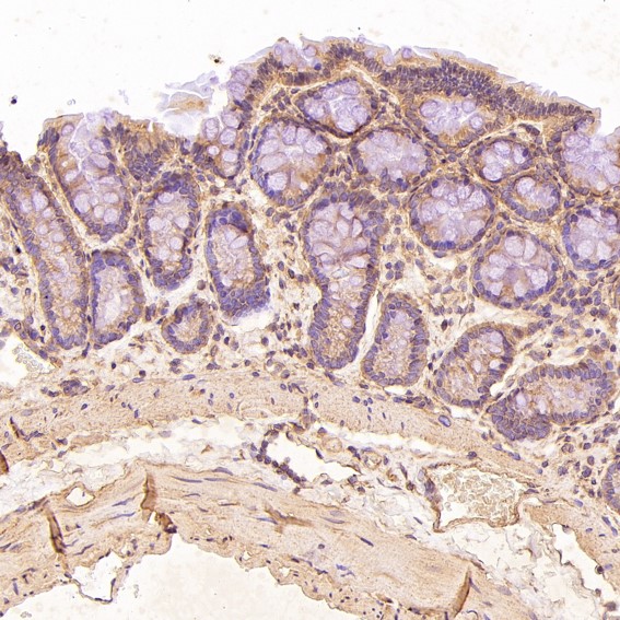 Rabbit Monoclonal to TRAF6