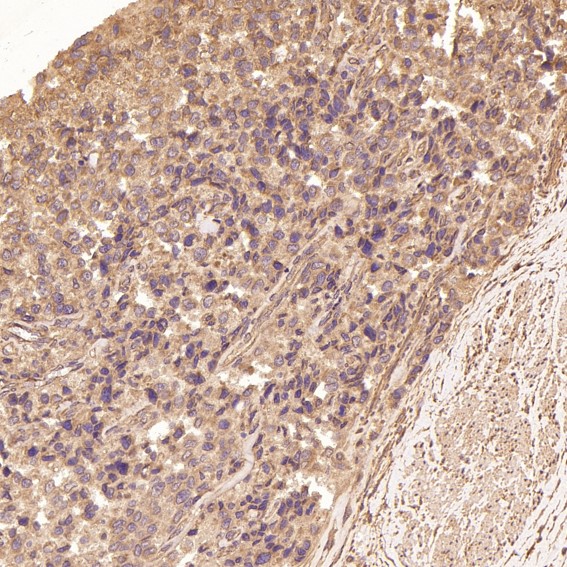 Rabbit Monoclonal to TRAF6