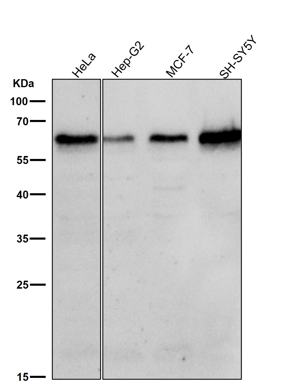 Rabbit Monoclonal to TRAF6