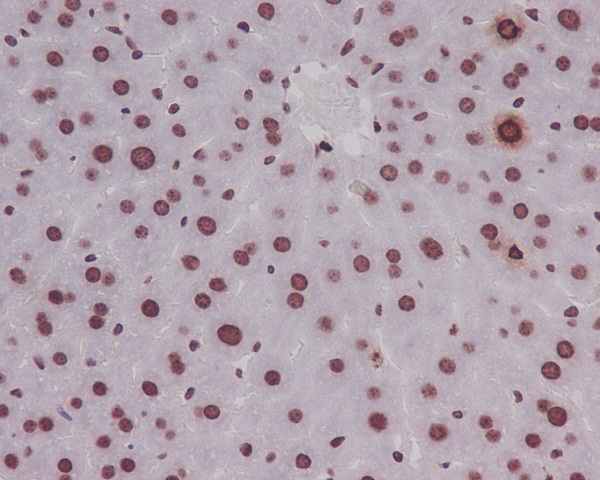 Rabbit Monoclonal to Phospho-HistoneH3(S10)