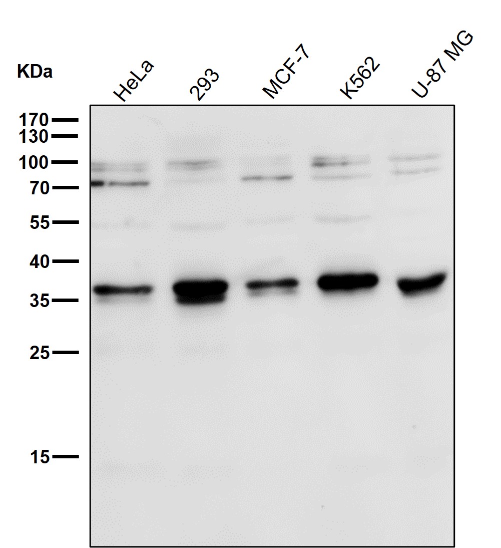 Rabbit Monoclonal to TorsinA