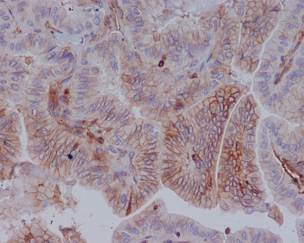 Rabbit Monoclonal to MHC classI