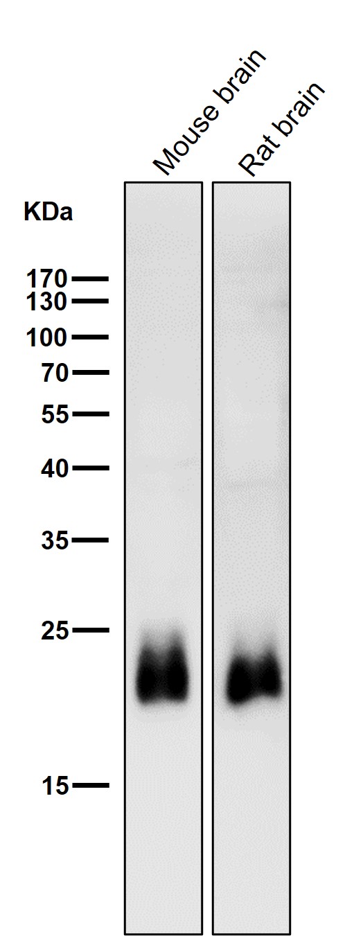 GTPase HRAS