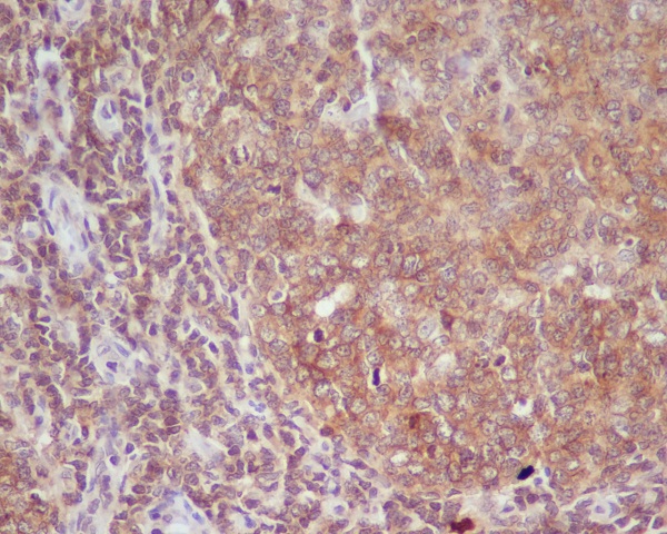 Rabbit Monoclonal to CD86