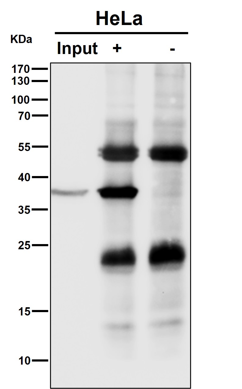 Rabbit Monoclonal to NMI