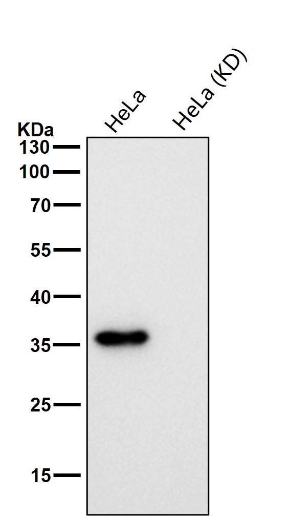Rabbit Monoclonal to NMI