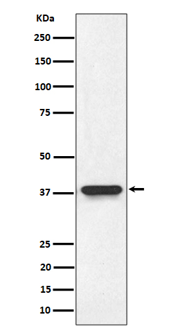 Rabbit Monoclonal to NMI