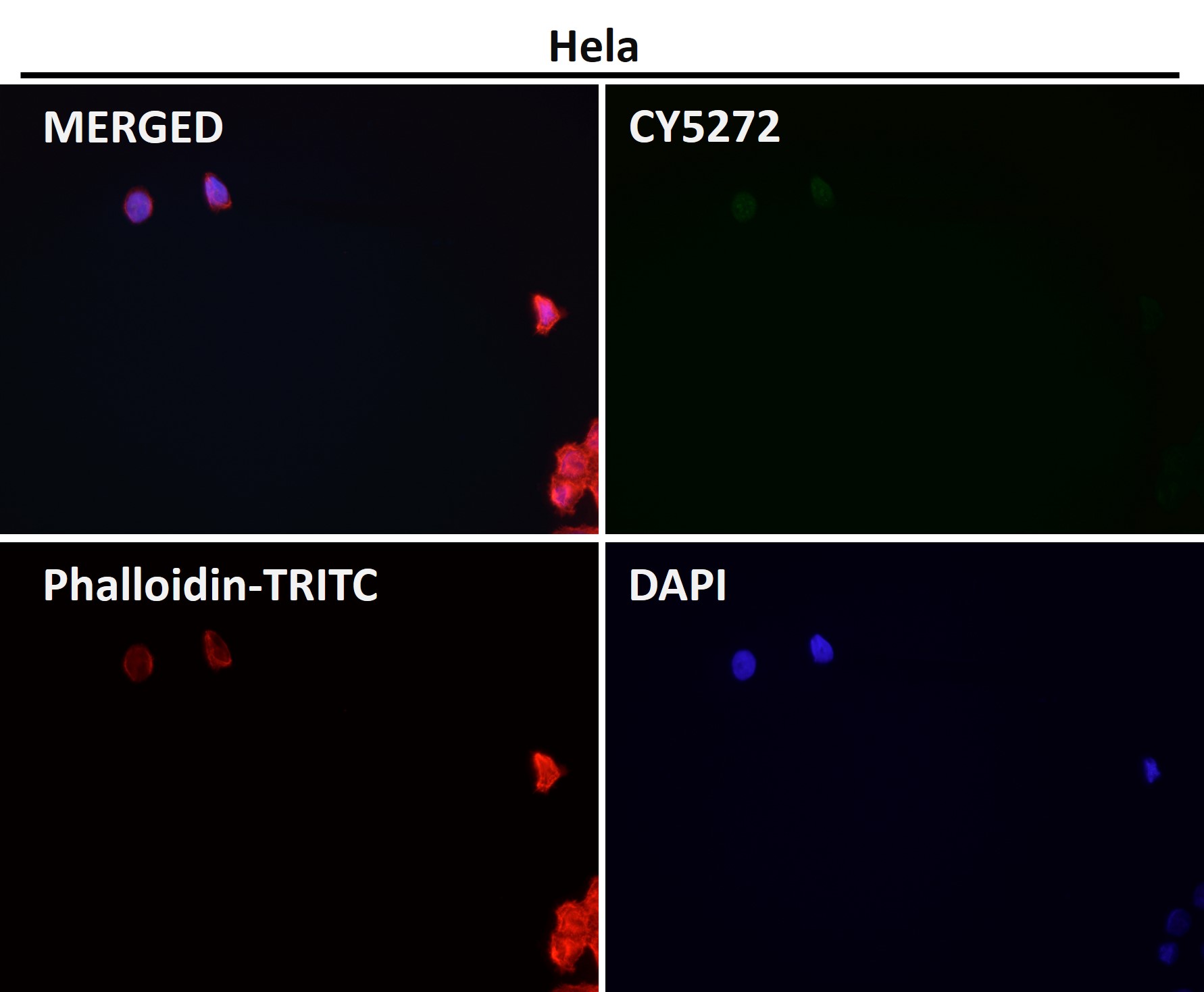 Rabbit Monoclonal to Histone H3(acetylK14)