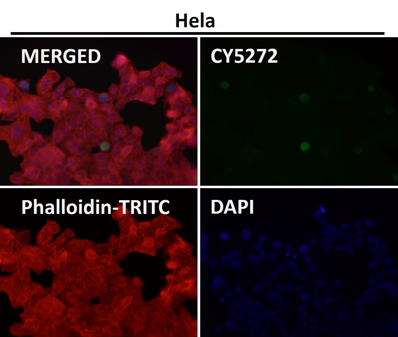 Rabbit Monoclonal to Histone H3(acetylK14)