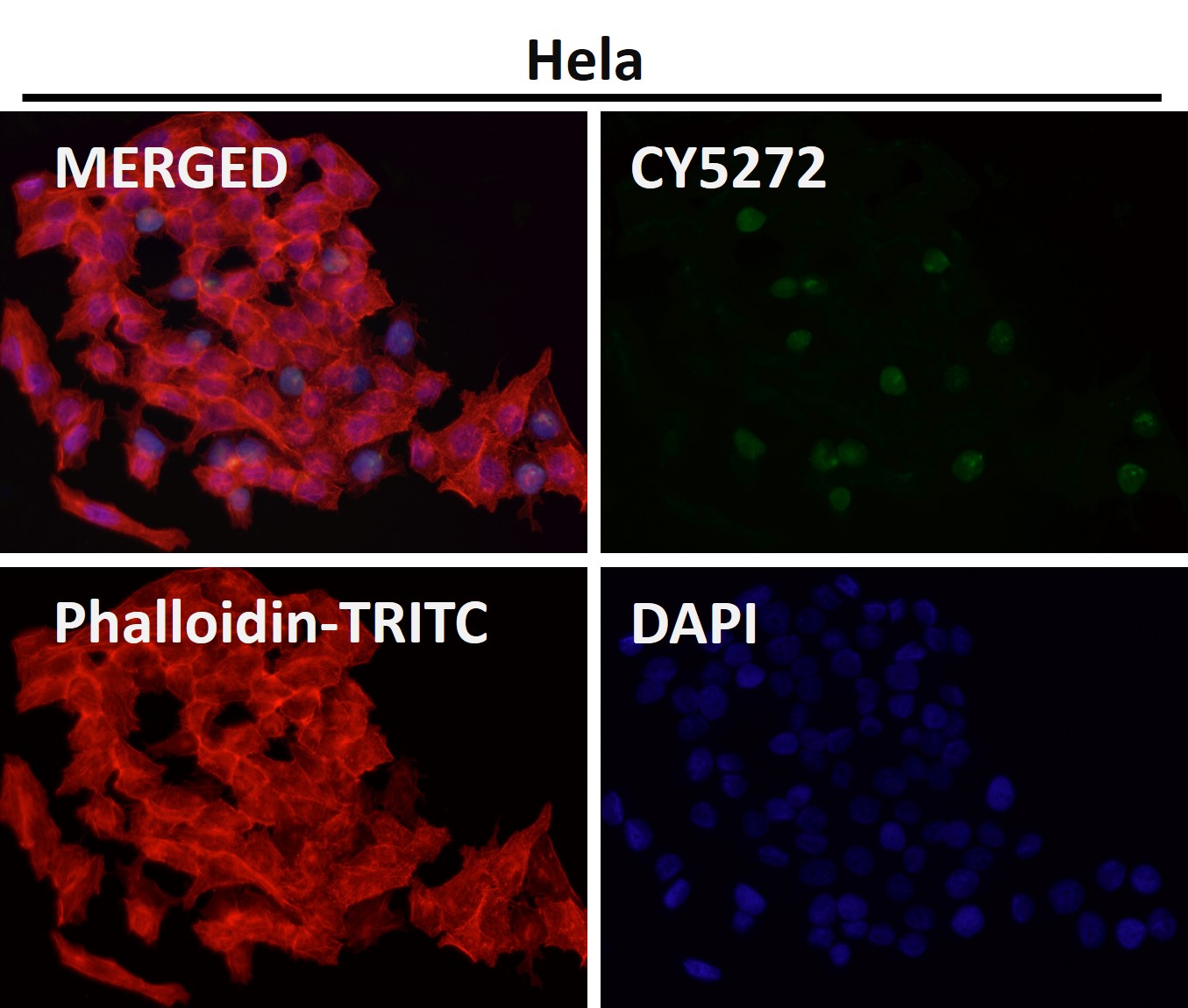 Rabbit Monoclonal to Histone H3(acetylK14)