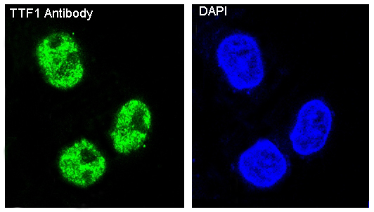 Rabbit Monoclonal to TTF1