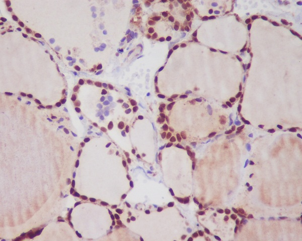 Rabbit Monoclonal to TTF1