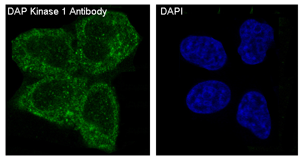 Rabbit Monoclonal to DAPKinase1