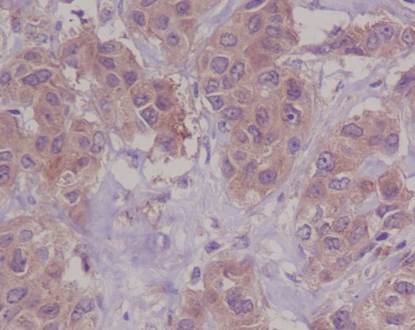 Rabbit Monoclonal to DAPKinase1