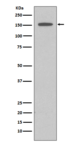 DAPKinase1