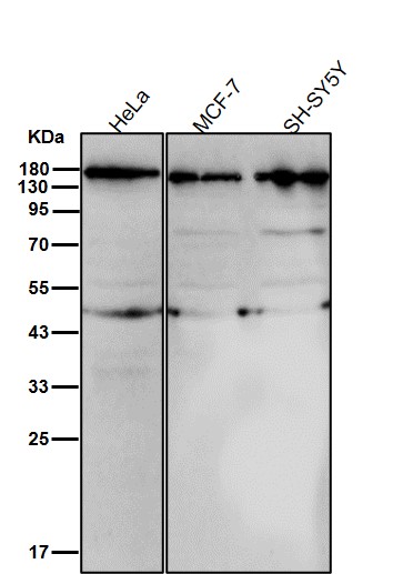 Rabbit Monoclonal to DAPKinase1