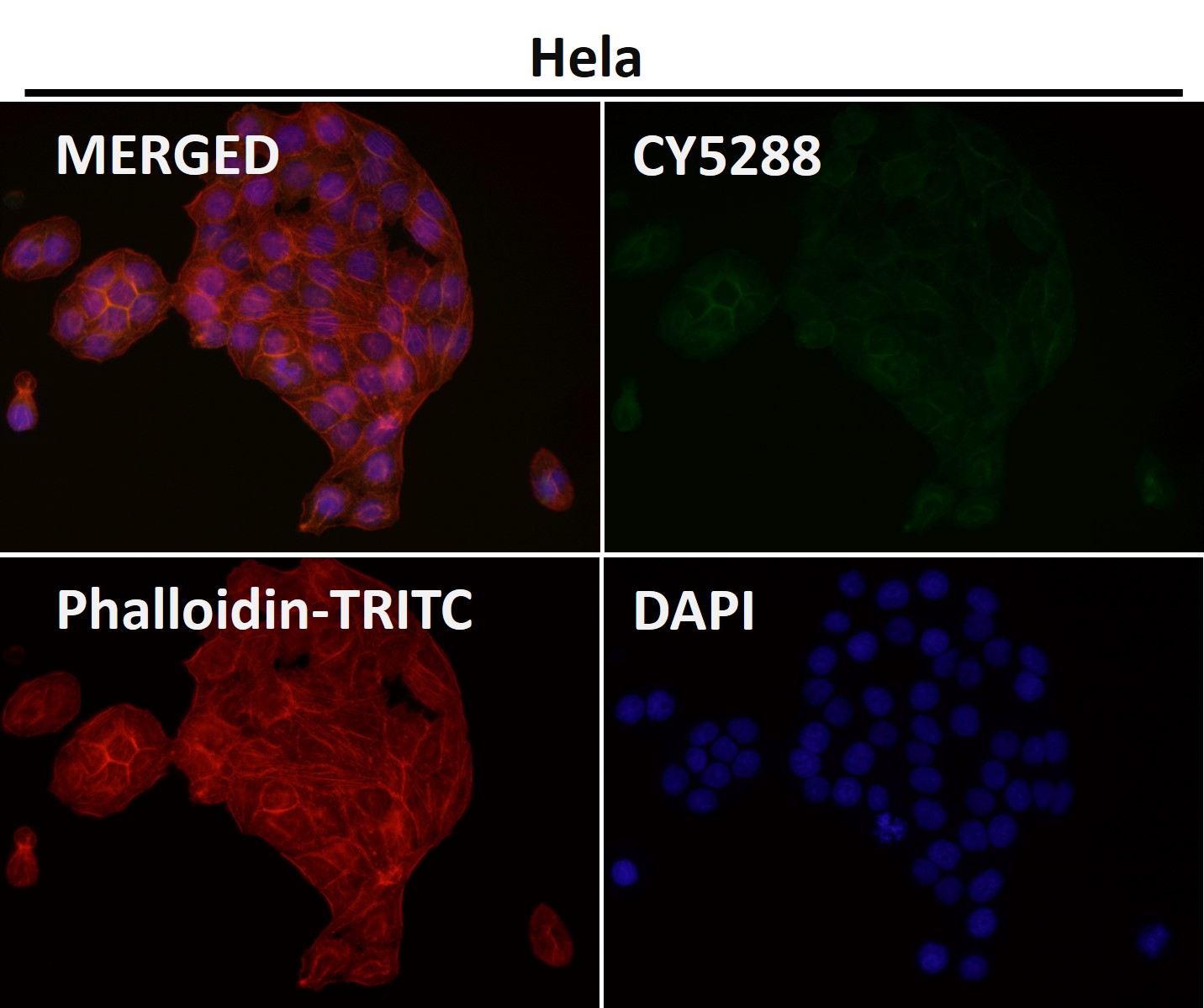 Rabbit Monoclonal to pan Cadherin