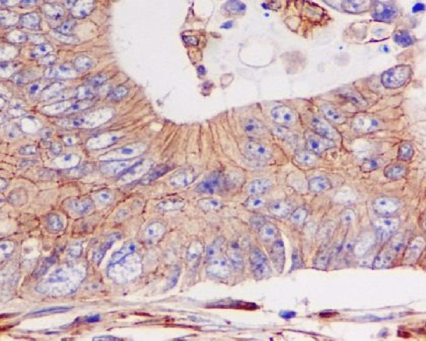 Rabbit Monoclonal to pan Cadherin