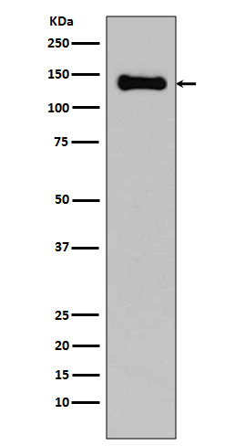 Rabbit Monoclonal to pan Cadherin
