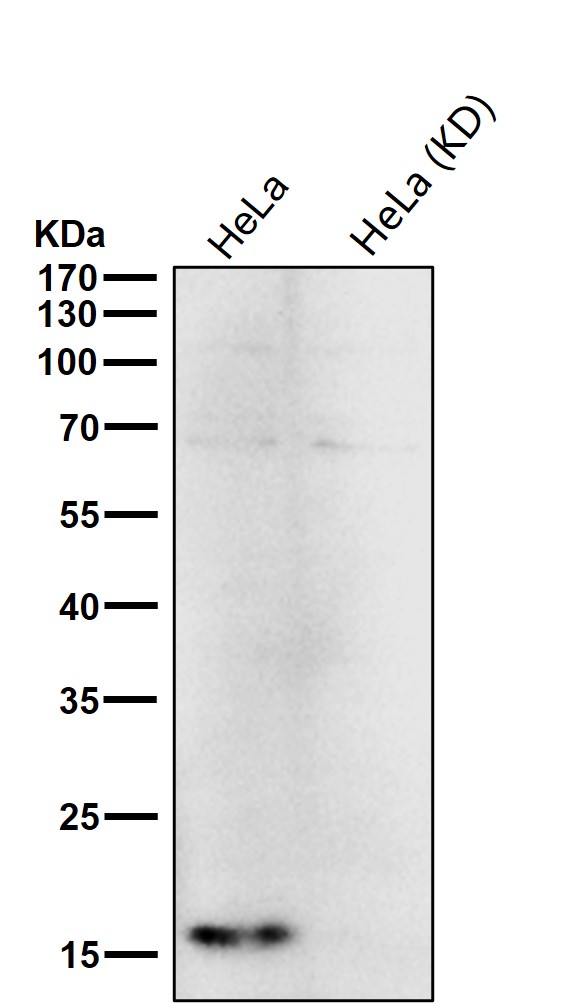 TCEB2