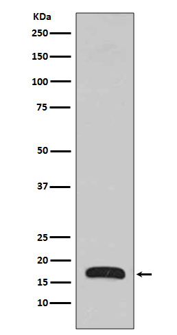Rabbit Monoclonal to p16 ARC
