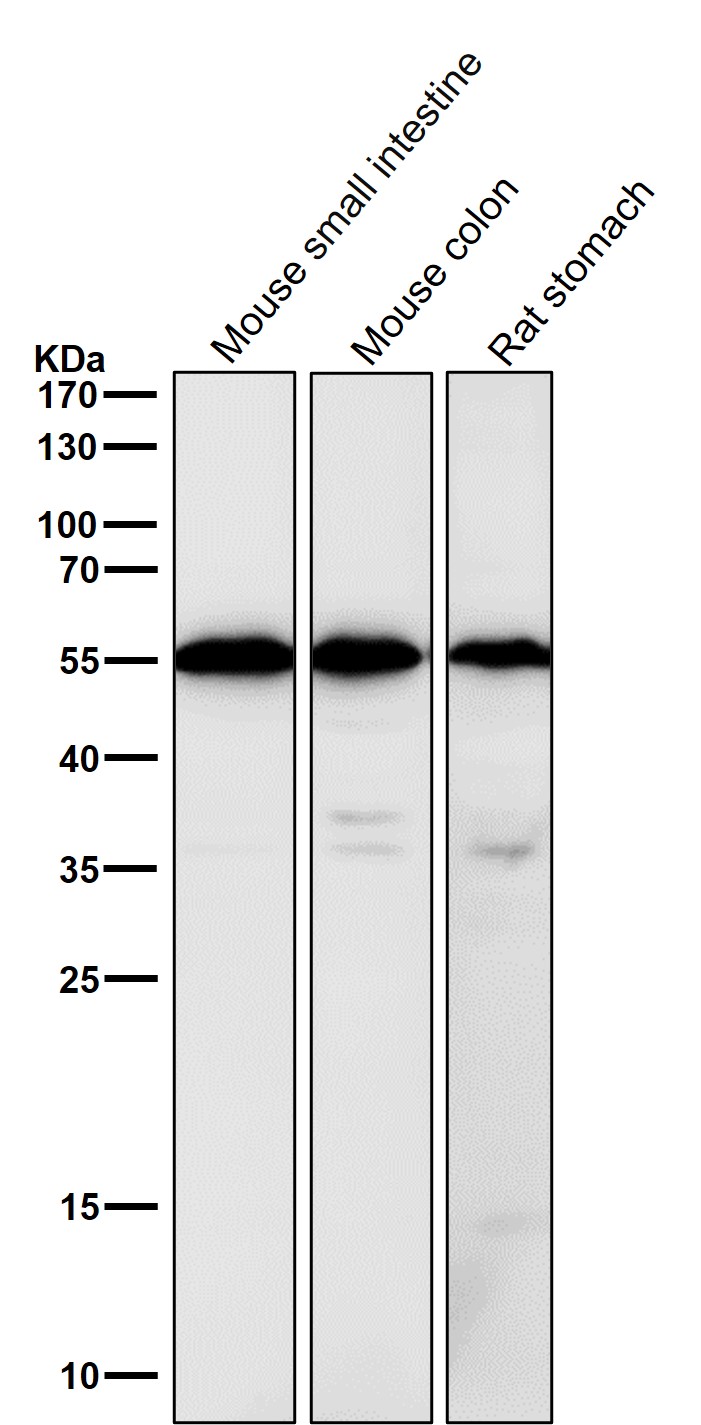Calreticulin