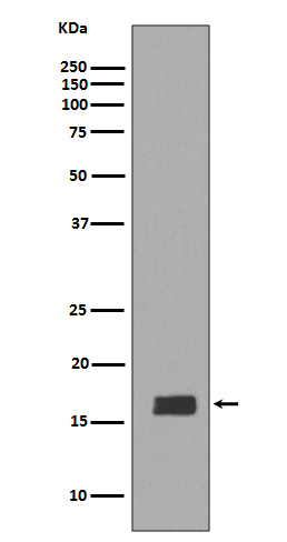 alpha/beta Synuclein