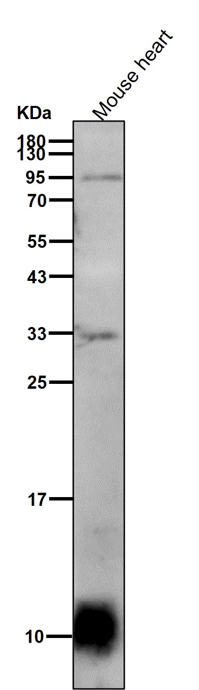 NDUFAB1