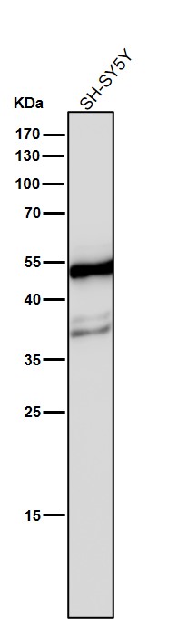 beta II Tubulin