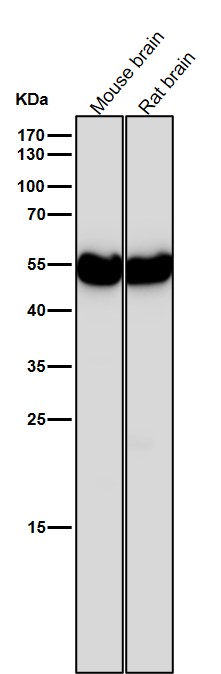 Rabbit Monoclonal to beta II Tubulin