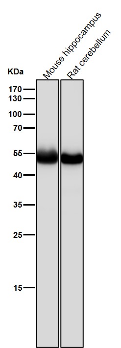 Rabbit Monoclonal to beta II Tubulin