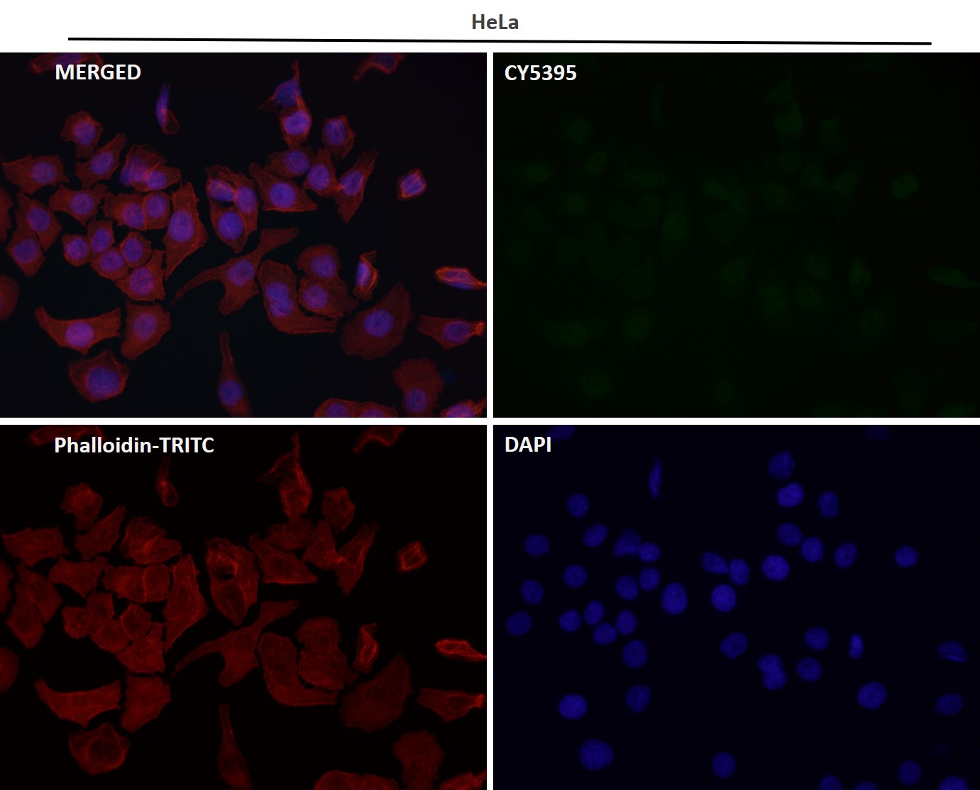 Rabbit Monoclonal to RUNX1/RUNX2/RUNX3
