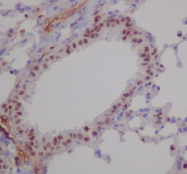 Rabbit Monoclonal to RUNX1/RUNX2/RUNX3