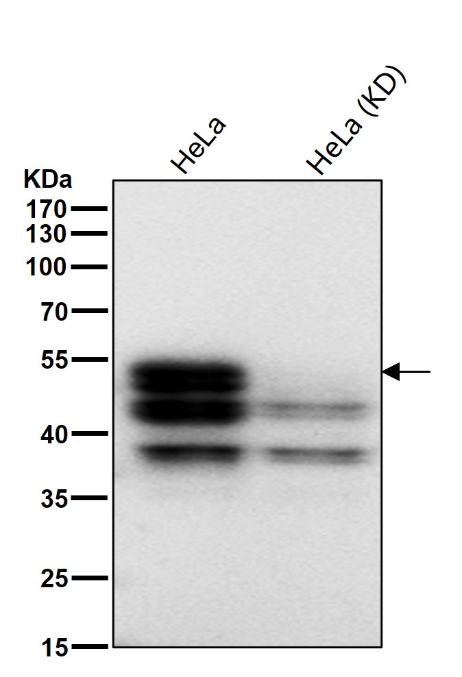 Rabbit Monoclonal to RUNX1/RUNX2/RUNX3