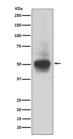 Rabbit Monoclonal to RUNX1/RUNX2/RUNX3