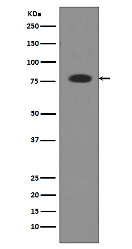 Transferrin