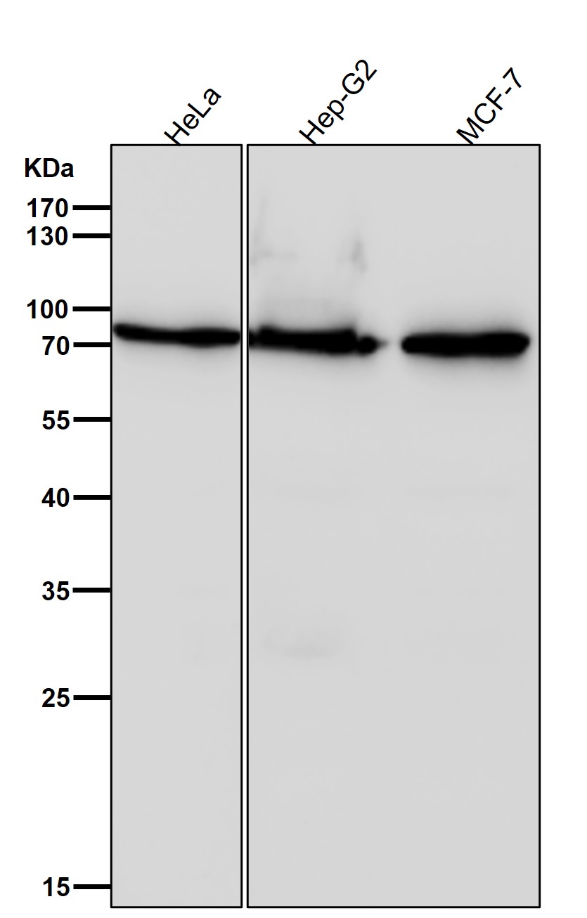Rabbit Monoclonal to ABCD1/ALD