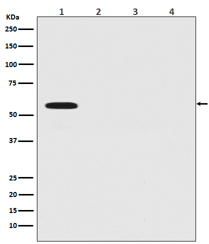 Firefly Luciferase