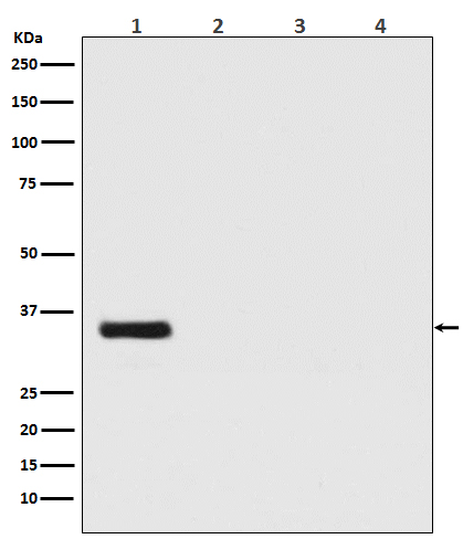 Renilla Luciferase