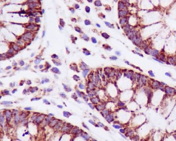 Rabbit Monoclonal to PBR