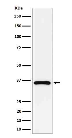 Rabbit Monoclonal to GAS2