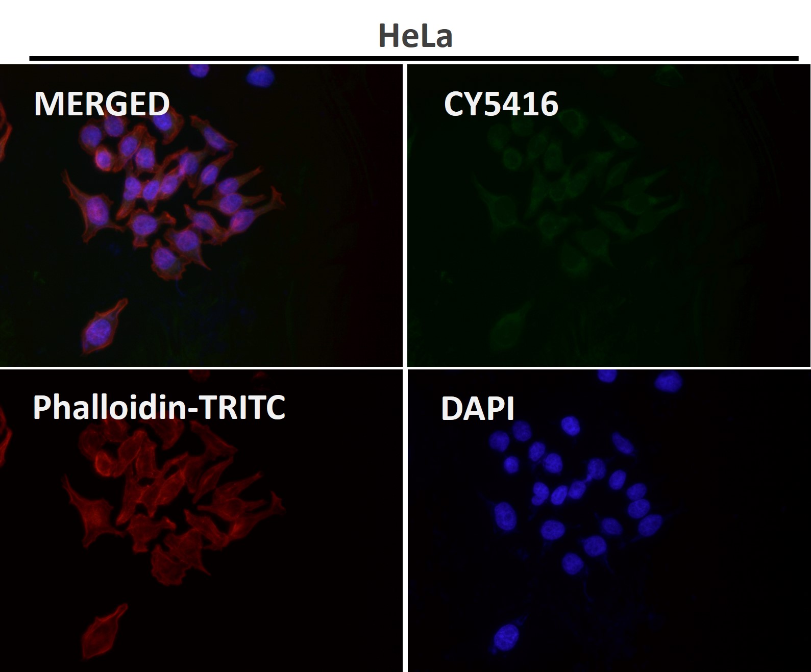 Rabbit Monoclonal to VDAC1