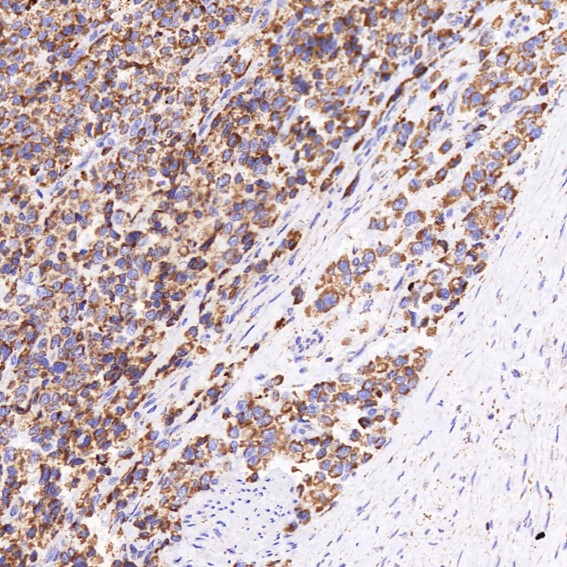 Rabbit Monoclonal to VDAC1
