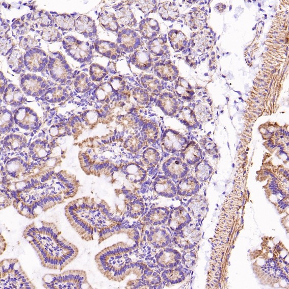 Rabbit Monoclonal to VDAC1