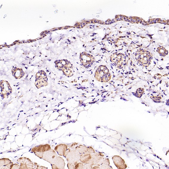Rabbit Monoclonal to VDAC1