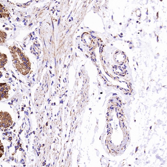 Rabbit Monoclonal to VDAC1